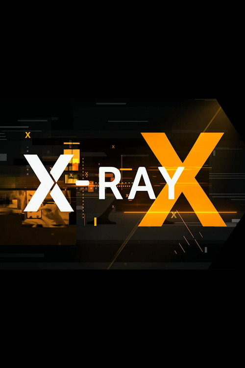 X-Ray poster