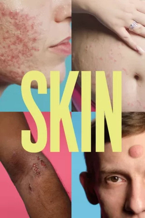 Skin poster